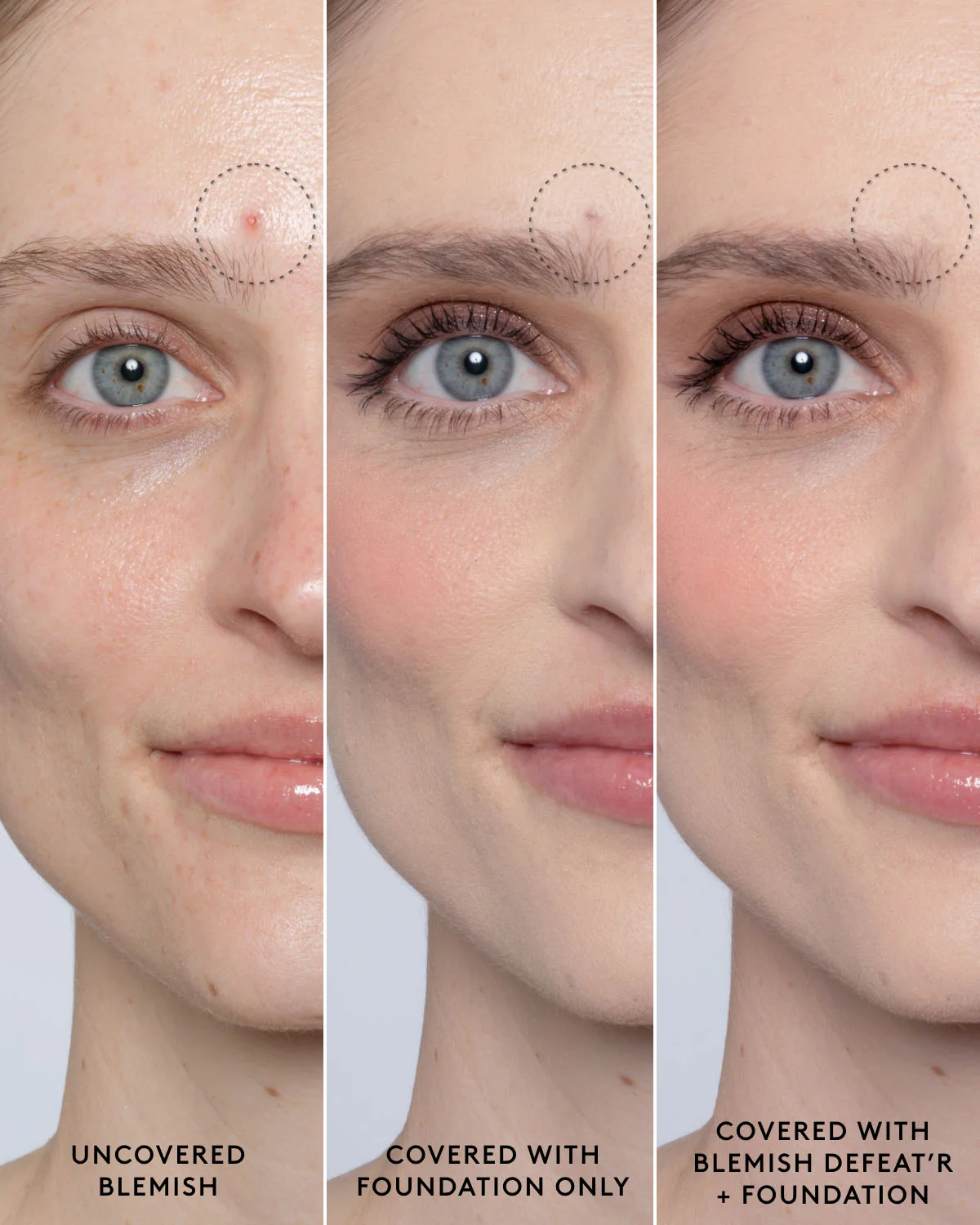 Blemish Defeat'r BHA Spot-Targeting Gel - Image 8