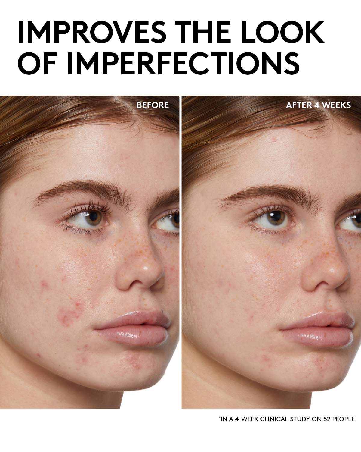 Fenty Skin Start’rs Full-Size Bundle with Mineral SPF: Oily Skin Edition - Image 4